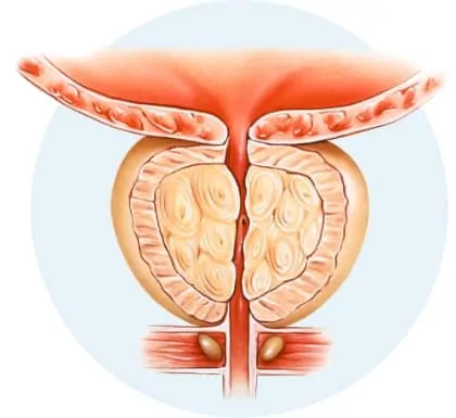 Здраве на простатата